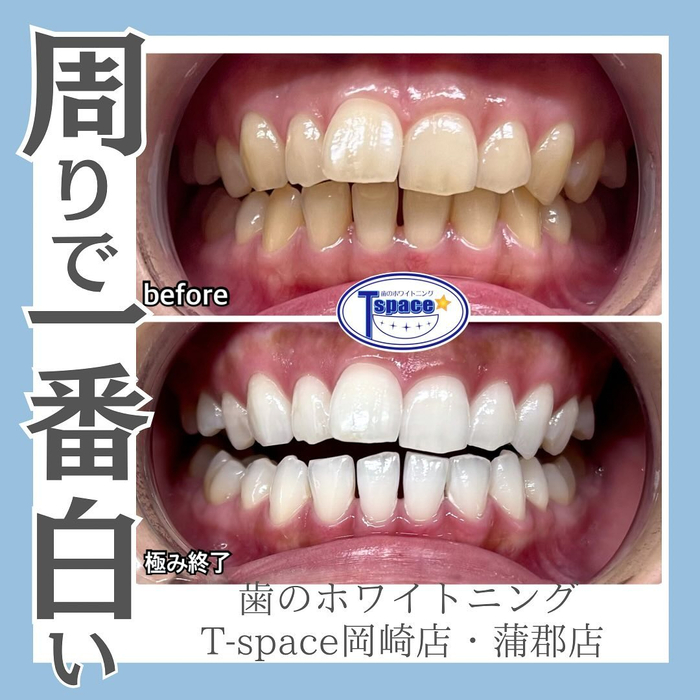 画像938