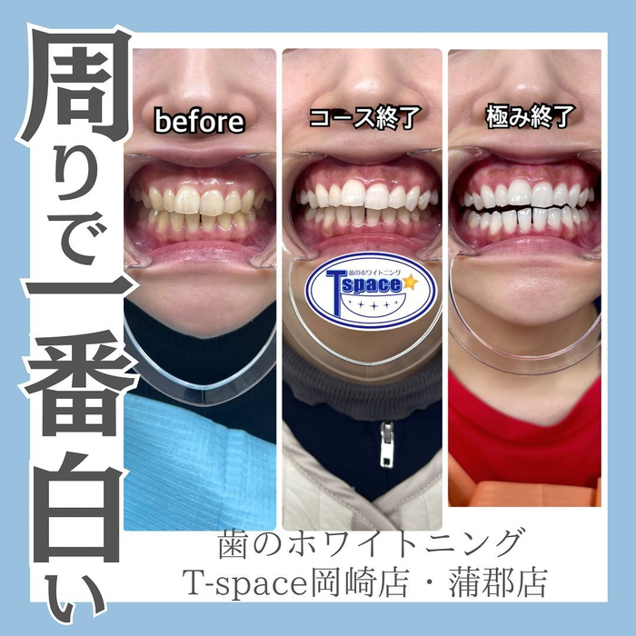 画像941