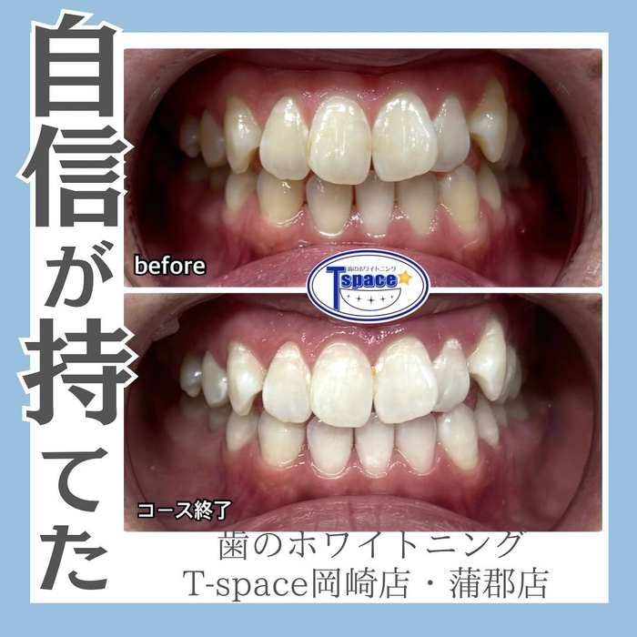 画像947