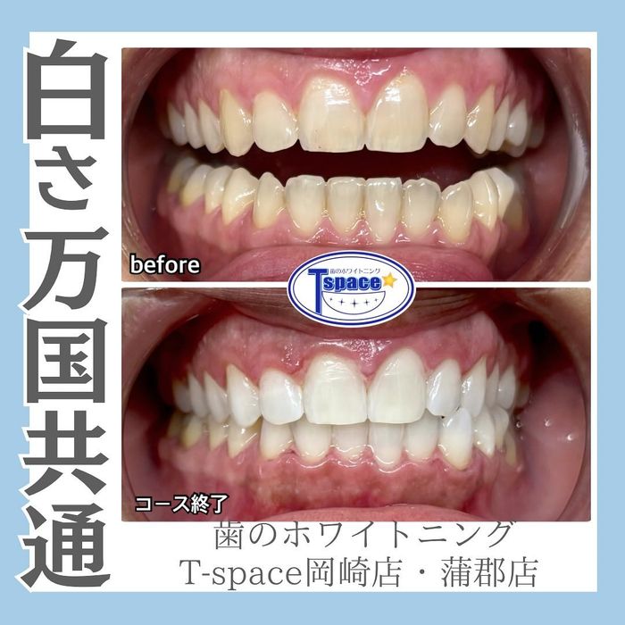 画像956