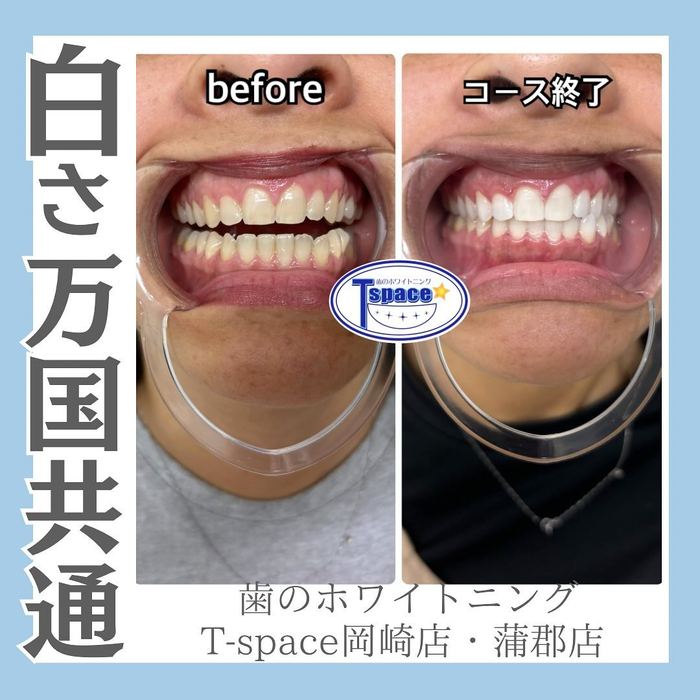 画像958