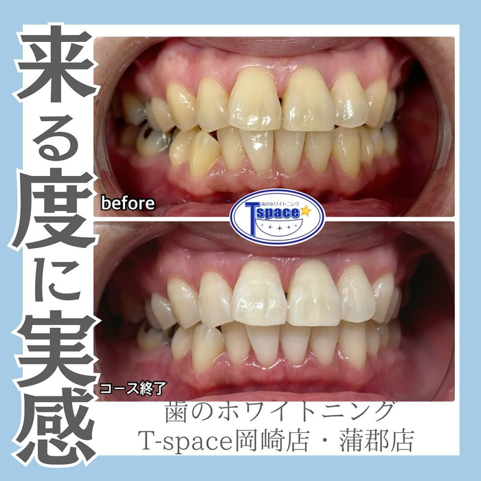 画像963