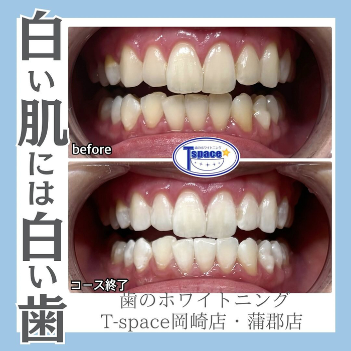 画像972