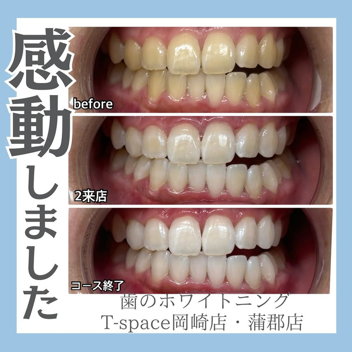 画像979