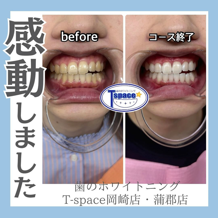 画像980
