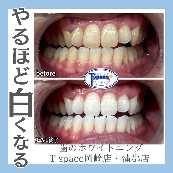 画像987