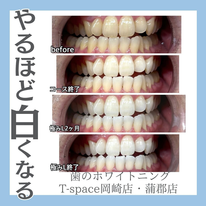 画像988