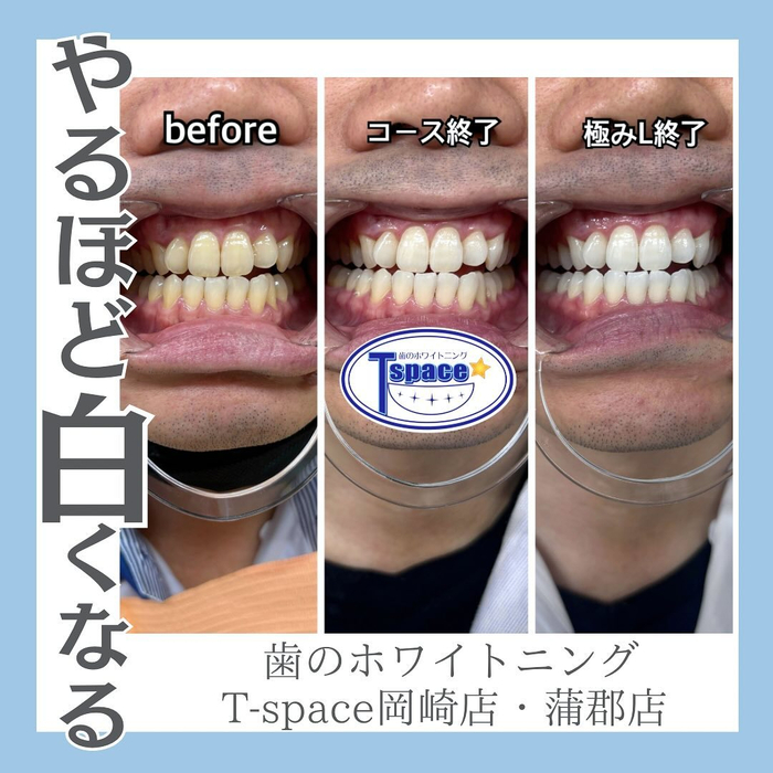 画像989