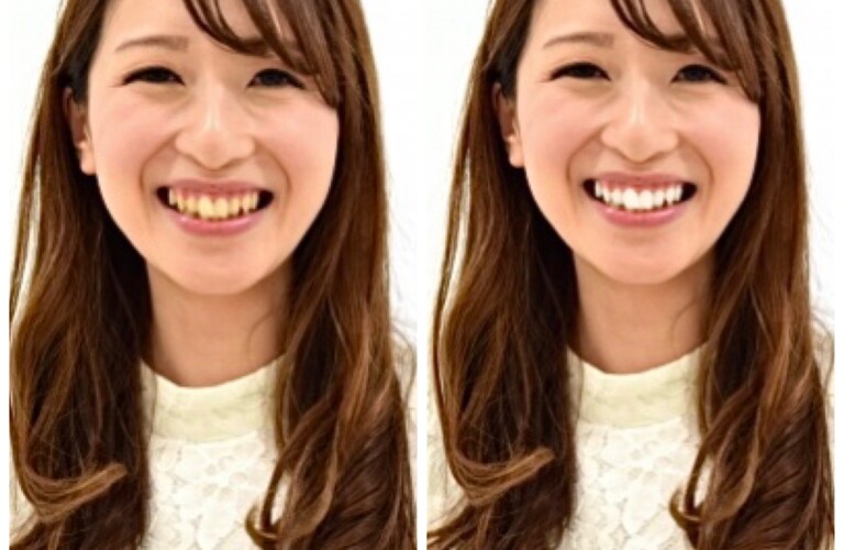 美しい歯で明るい笑顔を手に入れよう！